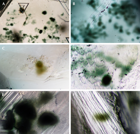 Figure 4. Radiation stains on surfaces of rough diamonds from Guyana, displaying variability in shape, hue, size, and opacity. Photomicrographs by Taryn Linzmeyer; fields of view 1.44 mm (A), 0.72 mm (B), and 0.288 mm (C–F). Figure 4. Radiation stains on surfaces of rough diamonds from Guyana, displaying variability in shape, hue, size, and opacity. Photomicrographs by Taryn Linzmeyer; fields of view 1.44 mm (A), 0.72 mm (B), and 0.288 mm (C–F).
