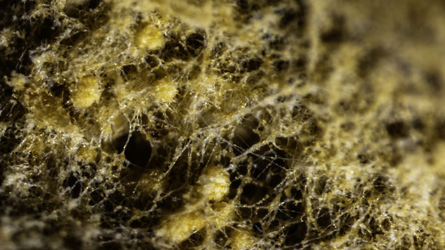 Figure 2. Thread-like filaments of the webbing with yellow globules trapped between them were observed on the non-nacreous area of the pearl. Photomicrograph by Eram Shaikh; field of view 8.00 mm. Figure 2. Thread-like filaments of the webbing with yellow globules trapped between them were observed on the non-nacreous area of the pearl. Photomicrograph by Eram Shaikh; field of view 8.00 mm.