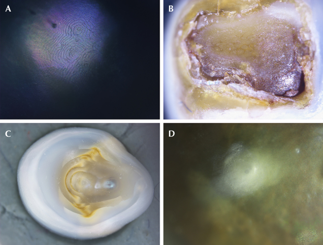 Figure 3. A: A spiral nacreous terrace structure on pearl A-2. B: The base of pearl C-4 with uneven organic-rich layers. C: Concave base on pearl D-4 with cores and nuclei seen through translucent nacre. D: Subsurface white spots on pearl B-1. Photomicrographs by Nishka Vaz; fields of view 0.5 mm (A), 1.3 mm (B), 3.2 mm (C), and 0.85 mm (D). Figure 3. A: A spiral nacreous terrace structure on pearl A-2. B: The base of pearl C-4 with uneven organic-rich layers. C: Concave base on pearl D-4 with cores and nuclei seen through translucent nacre. D: Subsurface white spots on pearl B-1. Photomicrographs by Nishka Vaz; fields of view 0.5 mm (A), 1.3 mm (B), 3.2 mm (C), and 0.85 mm (D).