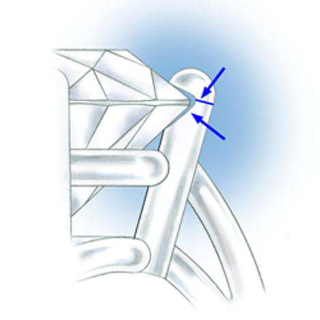 This prong is overcut and there is visible open space at the bearing This prong is overcut and there is visible open space at the bearing