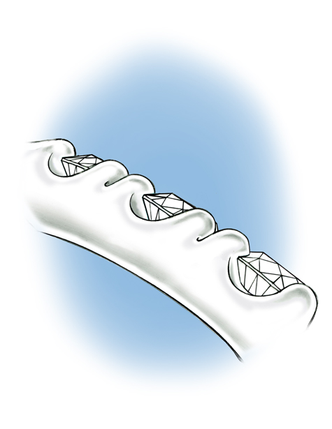 Close-up side view of a section of the shank of a platinum solitaire, featuring diamonds set in a bead-style prong setting. The side of the setting is visible. Close-up side view of a section of the shank of a platinum solitaire, featuring diamonds set in a bead-style prong setting. The side of the setting is visible.