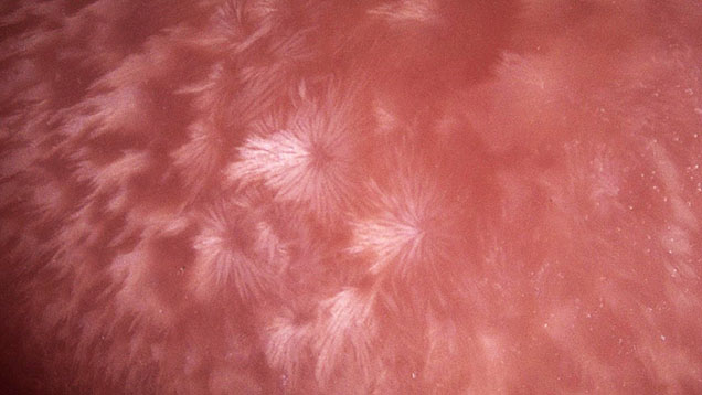 A 5.95 ct pink oval conch pearl exhibiting firework-like flame patterns. Photomicrograph by Hazel “Wing Kiu” Fan; field of view 5.98 mm. A 5.95 ct pink oval conch pearl exhibiting firework-like flame patterns. Photomicrograph by Hazel “Wing Kiu” Fan; field of view 5.98 mm.