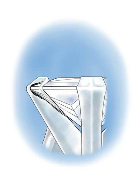 Close up cross-section illustration showing the chipped corner of a princess-cut platinum solitaire under the v-prong Close up cross-section illustration showing the chipped corner of a princess-cut platinum solitaire under the v-prong