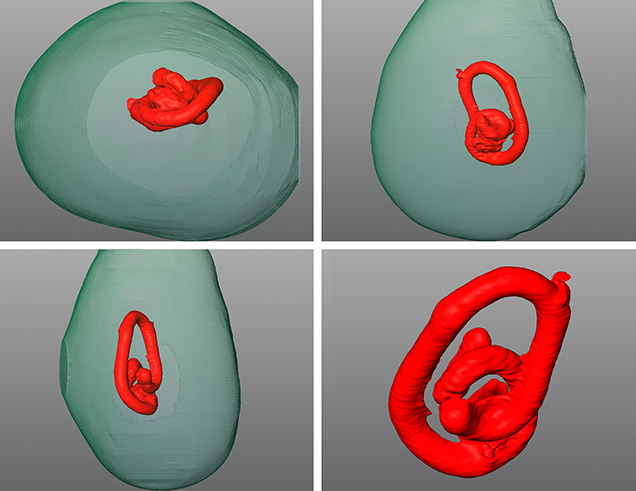 Figure 4. The 3D models generated using μ-CT scans revealed the tunnel-like feature (red) suspected of being parasite remnants or evidence of parasitic activity within the pearl. Figure 4. The 3D models generated using μ-CT scans revealed the tunnel-like feature (red) suspected of being parasite remnants or evidence of parasitic activity within the pearl.