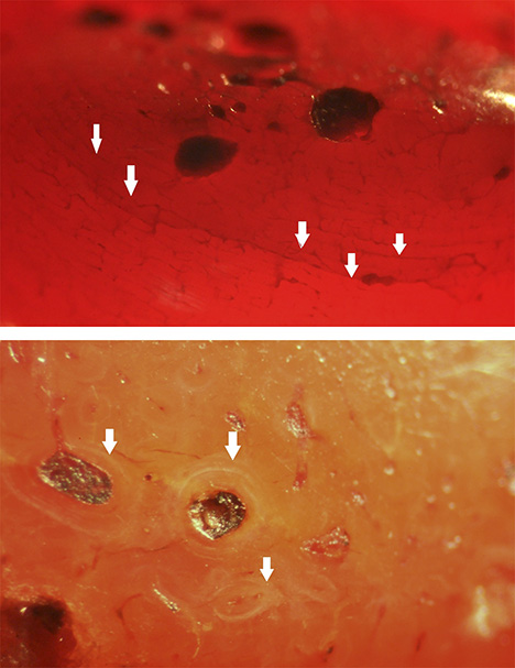 Dyed bone displays subparallel veins