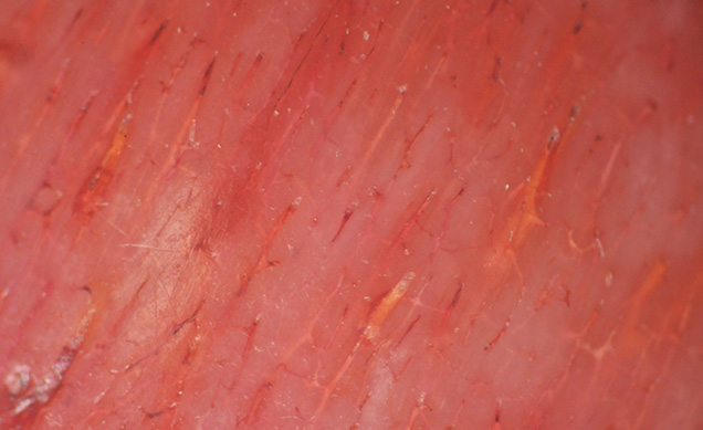 Dyed bone displays subparallel veins