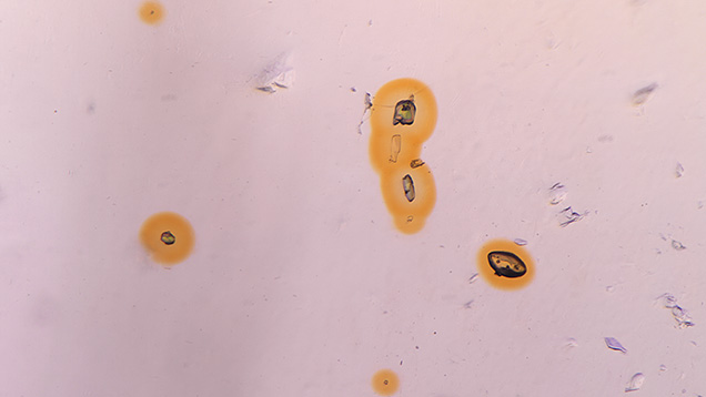 Figure 1. A view through the girdle displayed one of the lighter violet pleochroic colors of the iolite host, revealing a mix of monazite and zircon inclusions surrounded by yellow radiation halos. Note the colorless cores in the larger halos. Photomicrograph by Emily Jones; field of view 3.64 mm.