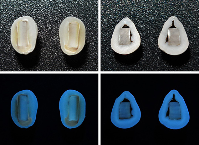 Cross sections of two “box bead” cultured pearl samples with their reactions under long-wave UV.