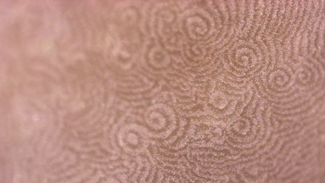 Figure 3. Spiral patterns formed by the platy layers of aragonite (nacre) observed on the surface. Photomicrograph by Lubna Sahani; field of view 1.44 mm. Figure 3. Spiral patterns formed by the platy layers of aragonite (nacre) observed on the surface. Photomicrograph by Lubna Sahani; field of view 1.44 mm.