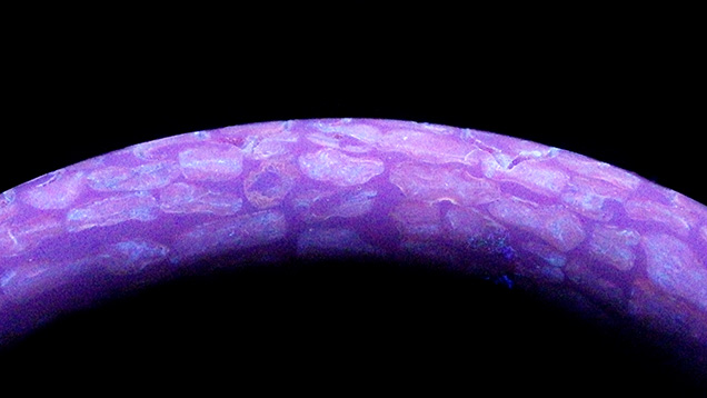 Short-wave ultraviolet fluorescence revealed a patchy pattern. Short-wave ultraviolet fluorescence revealed a patchy pattern.