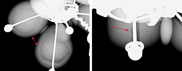 Figure 2. Real-time microradiography of the internal structures observed in the larger nose ring consisting of organic-rich acicular structures and growth arcs (left) and a “collapsed core” near the drill hole area surrounded by growth arcs (right). Figure 2. Real-time microradiography of the internal structures observed in the larger nose ring consisting of organic-rich acicular structures and growth arcs (left) and a “collapsed core” near the drill hole area surrounded by growth arcs (right).