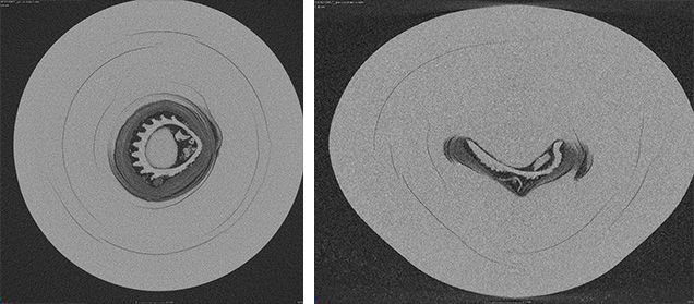 Conventional 2-D μ-CT slices of a pearl Conventional 2-D μ-CT slices of a pearl