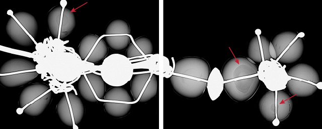 Figure 3. The majority of the pearls in the smaller nose ring showed faint growth arcs and concentric ringed structures, while three of them showed organic-rich acicular cores (marked with arrows) typical of natural pearls. Figure 3. The majority of the pearls in the smaller nose ring showed faint growth arcs and concentric ringed structures, while three of them showed organic-rich acicular cores (marked with arrows) typical of natural pearls.