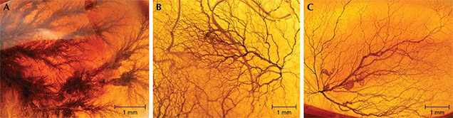 Dendritic inclusions in amber. Dendritic inclusions in amber.