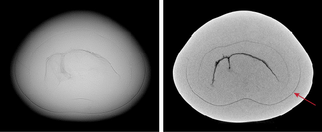 Figure 4. Left: RTX image of the pearl’s internal structure with a large linear feature. Right: μ-CT image showing a freshwater-type linear feature in the center and a faint boundary (arrow). Figure 4. Left: RTX image of the pearl’s internal structure with a large linear feature. Right: μ-CT image showing a freshwater-type linear feature in the center and a faint boundary (arrow).