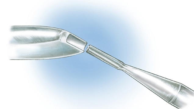 Use a cylinder burr to make a grooved prong pusher Use a cylinder burr to make a grooved prong pusher