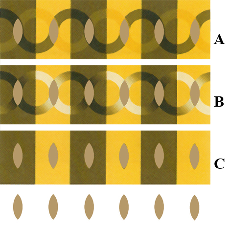 Figure 10 Gilbertson
