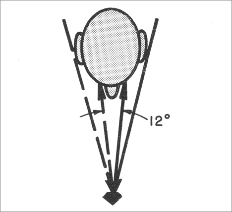 Figure 12 Gilbertson