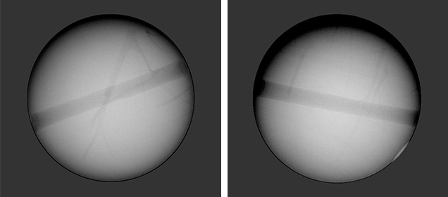 Shell pearl showing banding, cracks
