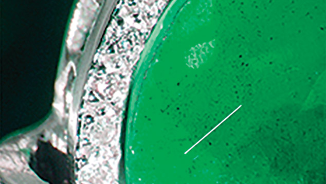 Small black spots in in beryl and topaz doublet Small black spots in in beryl and topaz doublet