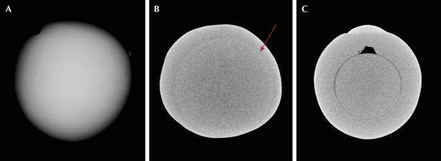 Figure 2. RTX (A) and μ-CT (B) imaging showing the subtle variation in radiopacity between the bead nucleus and the nacre (indicated by arrow). C. μ-CT scan of a bead cultured pearl for comparison showing the demarcation of the bead nucleus with a small organic gap. Figure 2. RTX (A) and μ-CT (B) imaging showing the subtle variation in radiopacity between the bead nucleus and the nacre (indicated by arrow). C. μ-CT scan of a bead cultured pearl for comparison showing the demarcation of the bead nucleus with a small organic gap.