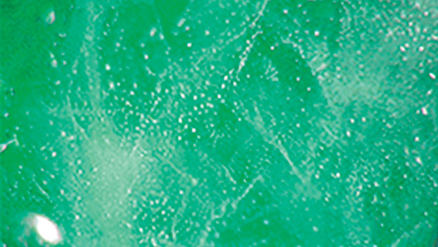 Fingerprint-like patterns in beryl and topaz doublet Fingerprint-like patterns in beryl and topaz doublet