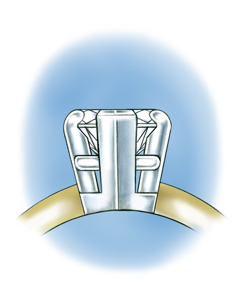 Close-up side view illustration of a pear-shaped center stone set in a five-prong platinum setting. Close-up side view illustration of a pear-shaped center stone set in a five-prong platinum setting.