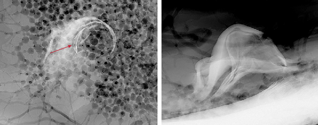 Figure 3. Left: RTX image of the top view of the 8.80 &times; 4.21 mm shell blister (arrow) with a network of parasitic boreholes and channels visible around it. Right: RTX image of the side of the shell blister with more radiopaque folds marking its outline.