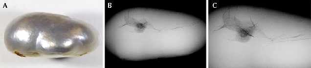 Microradiographs show a suspect linear feature.