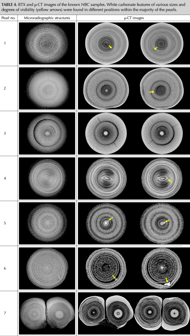 RTX and μ-CT images of the known NBC samples. White carbonate features of various sizes and degrees of visibility (yellow arrows) were found in different positions within the majority of the pearls. 
