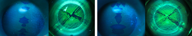 Ultra-short-wave illumination reveals the location of asterism.