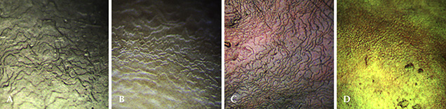 Surface nacreous structure of Kasumiga pearls