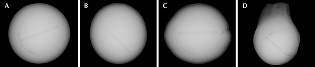 Microradiographs of undrilled shell-nucleated cultured pearls from Lake Kasumigaura