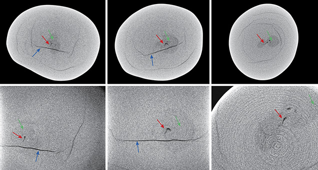 Three X-ray computed microtomography slices of a pearl