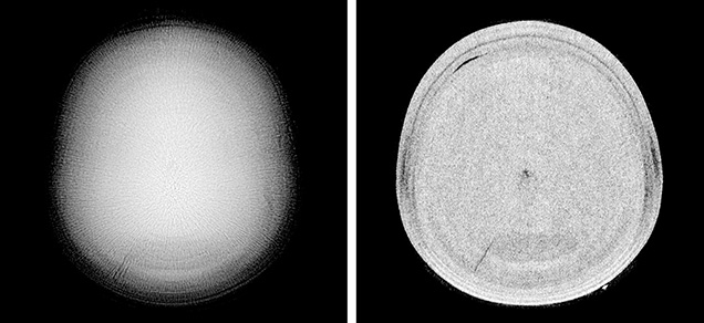 Figure 4. Left: RTX image revealing the calcitic nature of the pearl. Right: &mu;-CT scans showed a small core with a large acicular structure covering the entire area.