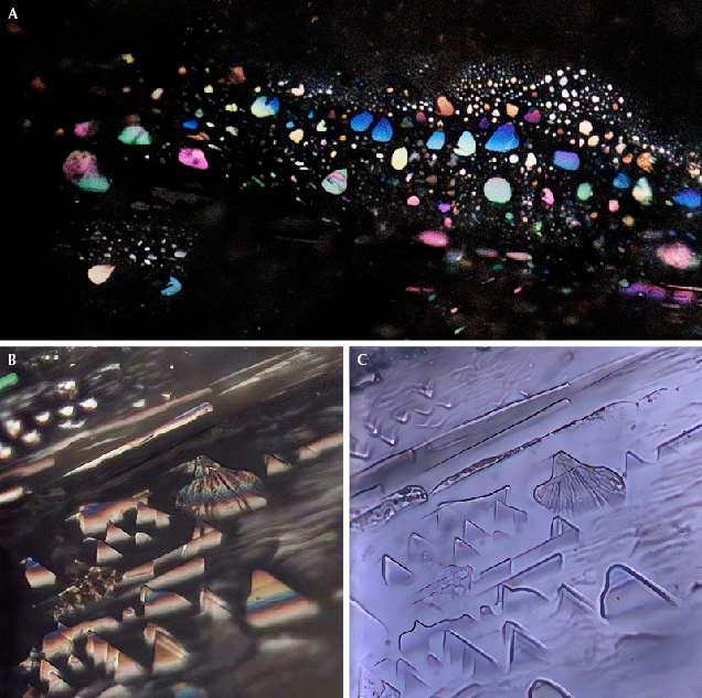 Figure 2. Inclusions along the white arms of trapiche-like sapphire. A: Thin-film inclusions display colorful interference colors under reflected light. B: Triangle-shaped fissures, which are perpendicular to the crystallographic <i>c</i>-axis, resemble overlapping hills, including a volcano just right of center. These fissures show spectral interference colors under reflected light. C: In transmitted light, the pattern of inclusions resembles a Chinese landscape painting with a volcano in it. Photomicrographs by Xiaojing Lai; fields of view 0.30 mm (A) and 0.15 mm (B and C).