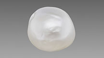 Figure 1. An 8.98 ct white semi-baroque cultured pearl measuring 11.31 × 10.75 × 10.30 mm exhibiting dents and wrinkles on its surface. Photo by Hemal Trivedi.
