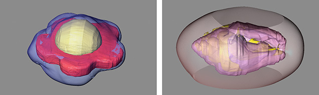 3D reconstructions of internal structures in bead-cultured pearls