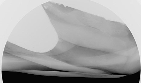 图 6：用于遮盖珍珠内部洞痕开口的材料（可能是贝壳）。